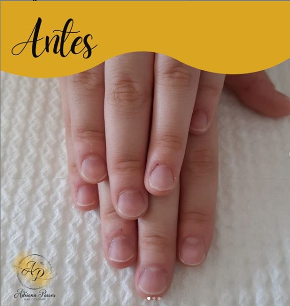 Blindagem de unhas é a nova tendência! Com naturalidade promete deixá-las super fortes e brilhantes
