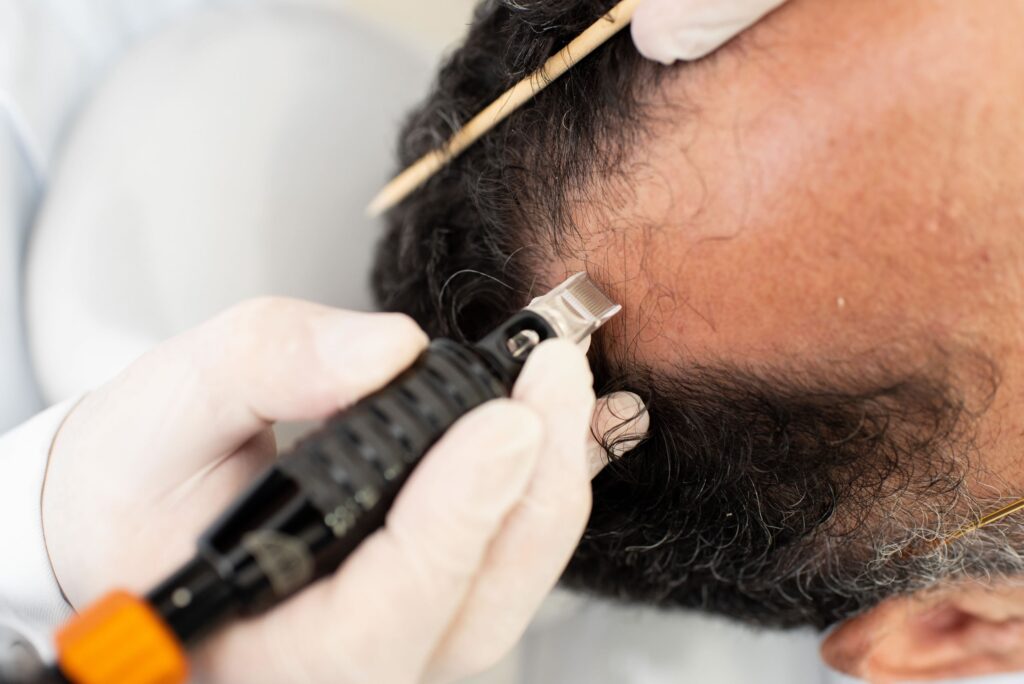 Redução de testa: Dermatologista de MS explica sobre melhores formas de tratamento Redução de testa: Dermatologista de MS explica sobre melhores formas de tratamento