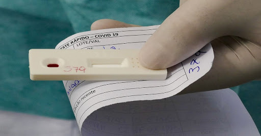 Brasil registra 938 mortes e 24.619 novos casos em 24 horas