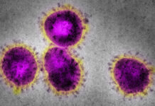 Transmissão da Covid-19 cai 45% em Dourados