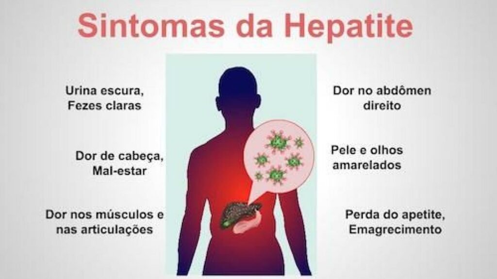 Trabalhadores da coleta de lixo deverão ter ações para prevenir Hepatite A Trabalhadores da coleta de lixo deverão ter ações para prevenir Hepatite A