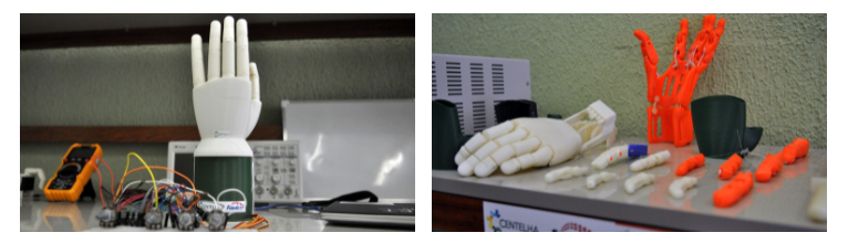 “Até chorei de emoção!”, disse Leonardo que terá “de volta” o braço com ajuda de prótese biônica