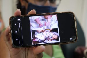 Crianças com deformidades ortopédicas tem vidas transformadas com cirurgias e tratamentos em CG