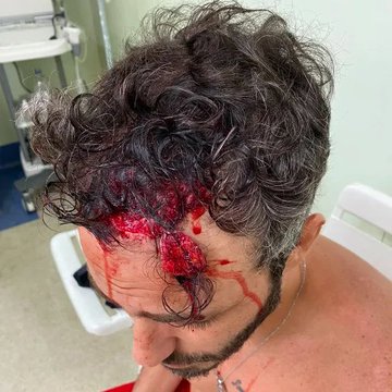 Ator Thiago Rodrigues é espancado por bandidos no Rio Ator Thiago Rodrigues é espancado por bandidos no Rio