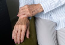 Especialista alerta que osteoporose evolui sem sintomas e reforça prevenção desde cedo