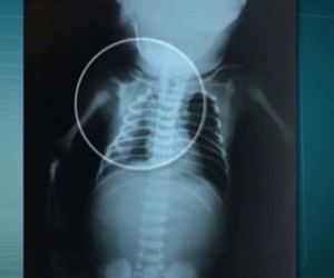 Bebê Arthur baleado na barriga da mãe morre depois de hemorragia Arthur foi baleado na barriga da mãe em 30 de junho - Reprodução