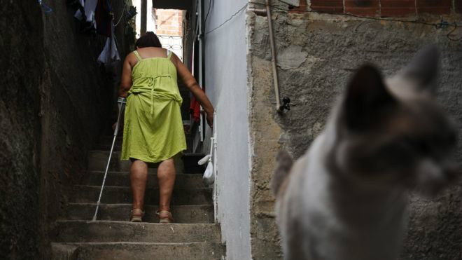 Chikungunya provoca doenças vasculares irreversíveis em pacientes, revela pesquisa Vera Marques passou a usar muleta quando sente as pernas muito pesadas um ano depois de sentir os primeiros sintomas da chikungunya.
(Foto: Paulo Paiva)