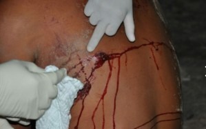 A vítima foi levada para o Hospital Regional Álvaro Fontoura. Foto: Alisson Silva/Edição MS
