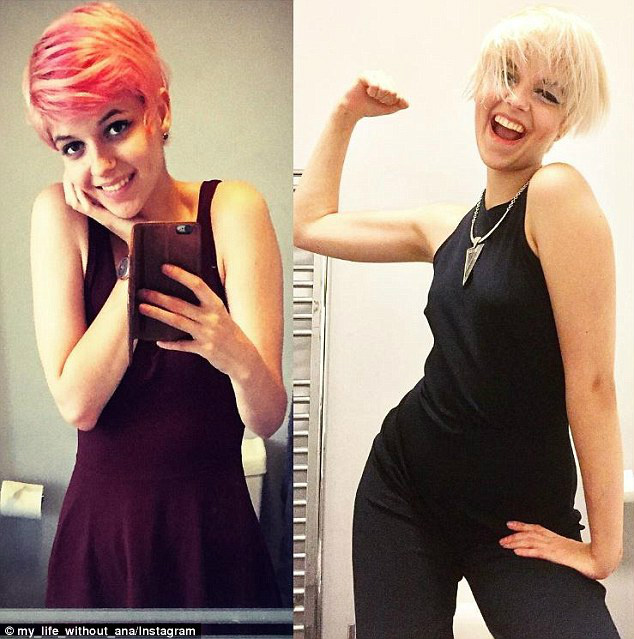 Jovem que quase morreu de anorexia mostra que a recuperação é possível Jovem que quase morreu de anorexia mostra que a recuperação é possível