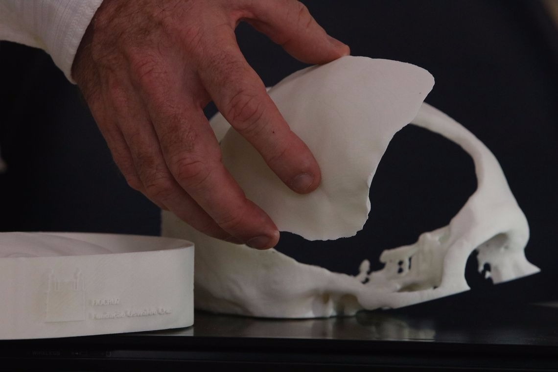 Brasileiros desenvolvem tecnologia de reconstrução craniana Fernando Frazão/Agência Brasil
