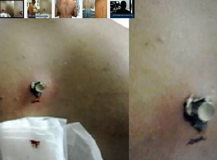 Sobrenatural! Homem leva tiro nas costas e algo surpreendente acontece Foto: Reprodução/Rede Record