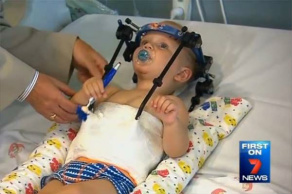Cabeça de bebê se desprende do pescoço Jackson sofreu uma decapitação interna / Reprodução / 7 News Melbourne