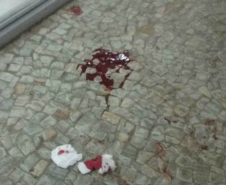 Motorista de senador derruba deputado com soco na entrada do Congresso Detalhe do sangue do deputado, em foto da repórter Fernanda Calgaro, do portal G1