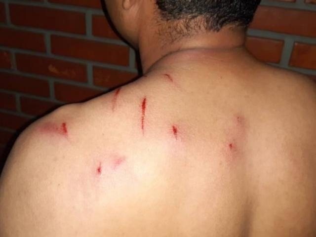 A vítima foi agredida pelos assaltantes. Márcio Ferreira Neto/MS em Foco