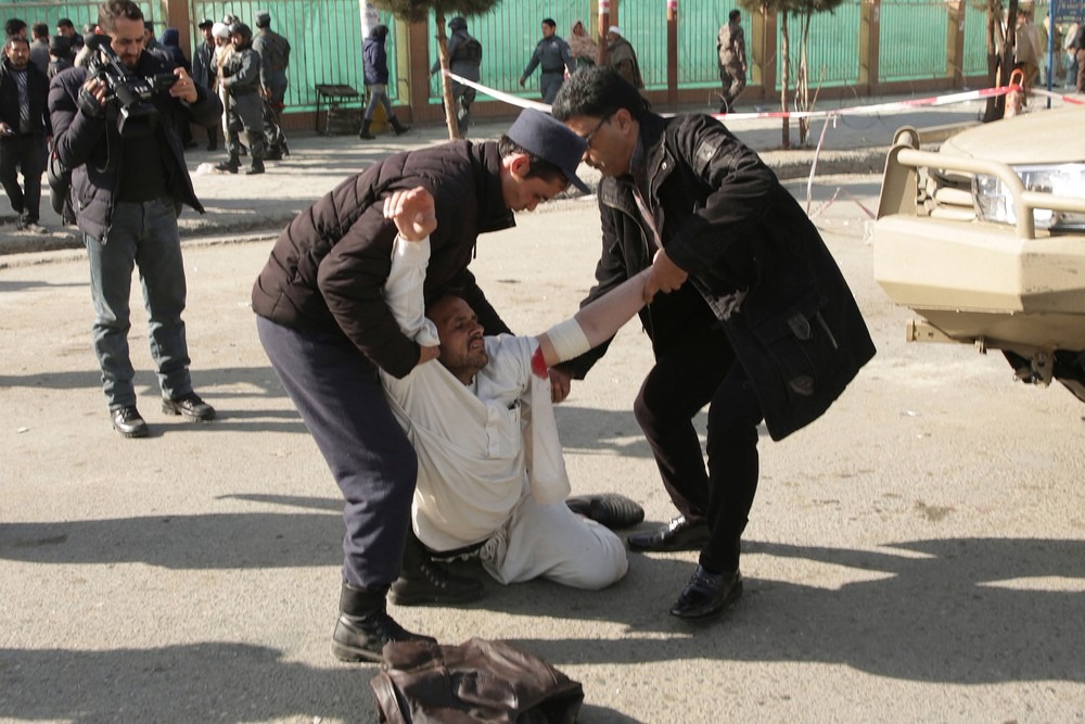 Explosão em hospital de Cabul deixa mortos e mais de 100 feridos Ferido recebe ajuda após explosão de carro-bomba em Cabul, no Afeganistão, neste sábado (27) (Foto: Massoud Hossaini/ AP)