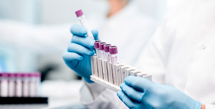 Laboratórios de MS são obrigados a informar casos suspeitos e positivos do Covid-19 Divulgação