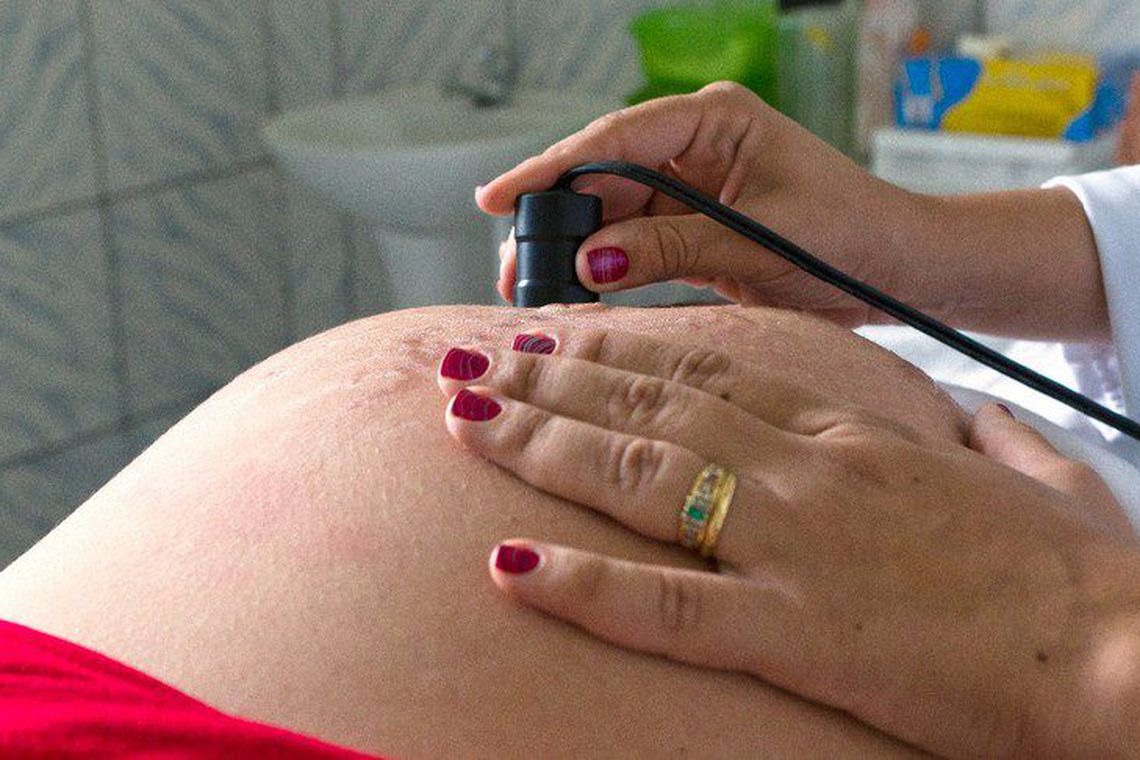 Número de grávidas com HIV aumenta quase 40% em dez anos Ana Nascimento/MDS/Portal Brasil
