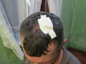 Magno ficou ferido na cabeça após telha cair