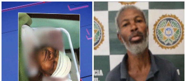 Homem arranca parte do couro cabeludo da mulher em Teresópolis; ele responderá por tentativa de homicídio
Rede Record