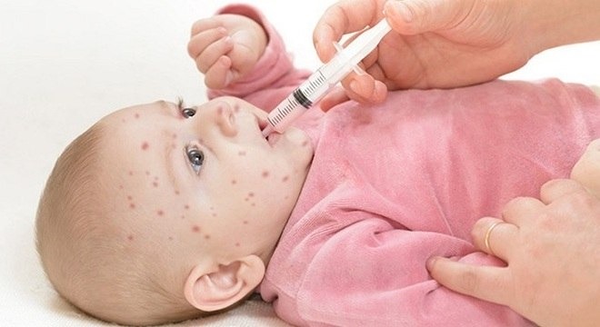 Como proteger bebês com menos de 6 meses do sarampo Saiba como proteger bebês com menos de 6 meses do sarampo
Flickr/Leni Suryani