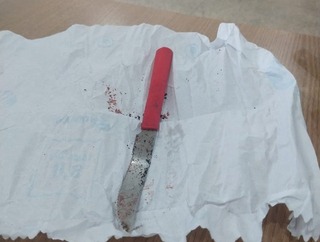 Homem é esfaqueado em bar e vai andando pedir ajuda em hospital