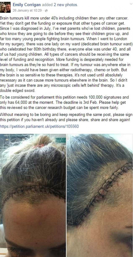 Mulher que sentia “apenas” dor de cabeça e cansaço descobre ter um tumor no cérebro Mulher que sentia “apenas” dor de cabeça e cansaço descobre ter um tumor no cérebro