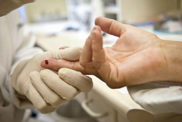 Jovens com HIV relatam avanços na qualidade de vida e destacam prevenção Teste para detectar o vírus HIVArquivo/Agência Brasil