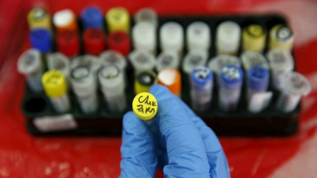 Zika Vírus ainda está em estudo (Foto: Divulgação)
