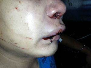 Alex matou uma e feriu duas pessoas na Moreninha III, e acabou agredido por populares. (Foto: Renan Nucci)