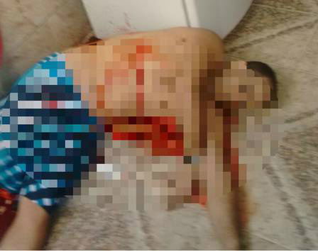 Traficante Playboy é morto em operação no Morro da Pedreira Imagem mostra Playboy ferido Foto: Divulgação