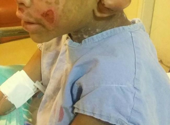 Criança deve perder a visão por causa das agressões (Conselho Tutelar)
