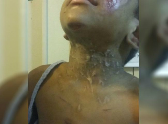 Tios torturam criança de 4 anos em Campo Grande e culpam 'vozes do diabo'