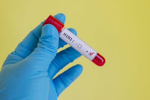Sobe para 65 mortes confirmadas por gripe no MS, segundo boletim Sobe para 65 mortes confirmadas por gripe no MS, segundo boletim