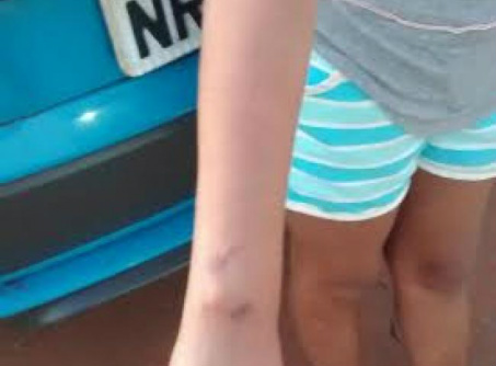 Vítima estava presa no banheiro, onde era agredida constantemente pelo marido.