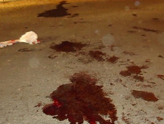 A vítima foi socorrida para o Hospital Municipal, onde não resistiu aos ferimentos e veio a óbito.