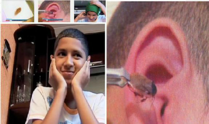 Barata entra em ouvido de menino e pai retira inseto 20 dias depois: "Sentia a asa dela batendo" Foto reprodução