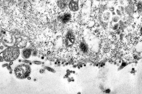 Brasil tem 1.057 mortes por coronavírus; casos chegam a 19.638 Brasil detectou 1º caso de covid-19 em 26 de fevereiro
Débora Barreto/Fiocruz/EFE
