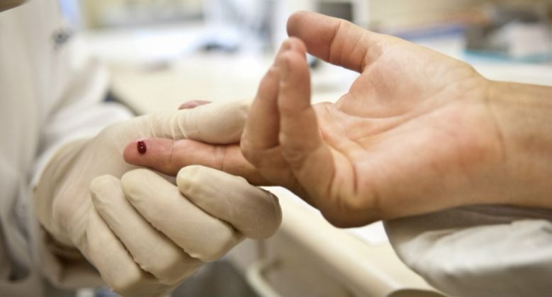 SUS oferece tratamento completo e gratuito a portadores de HIV SUS oferece tratamento completo e gratuito a portadores de HIV