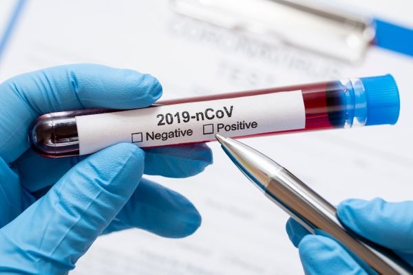 Covid-19: Brasil chega a 526,4 mil casos e 29,9 mil mortes