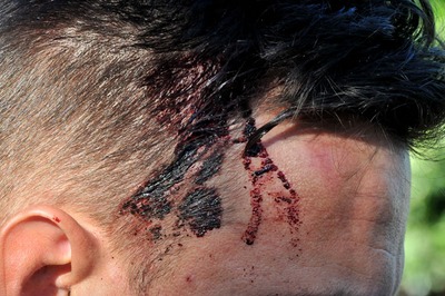 Em sessão de tortura, grupo armado rouba R$ 10 mil de sacoleiros em van Sacoleiro de 38 anos foi agredido com coronhadas. - Foto: Valdenir Rezende