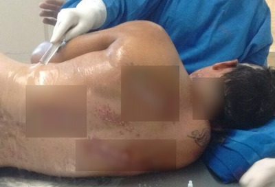 Serralheiro leva choque 270 vezes maior que tomada residencial Homem sobreviveu a choque de 30 mil volts, diz família (Foto: João Paulo Souza/Arquivo Pessoal)