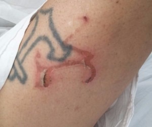 Vítima foi levada para o hospital Regional de Ponta Porã - Divulgaçã