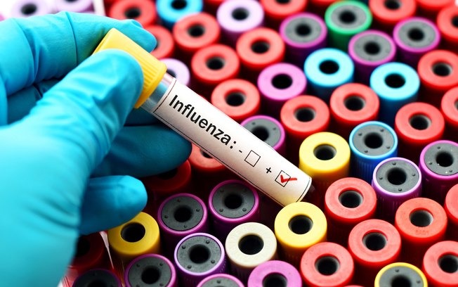 MS já registra 13 mortes por influenza neste semestre Em 2017 foram apenas 6 mortes.