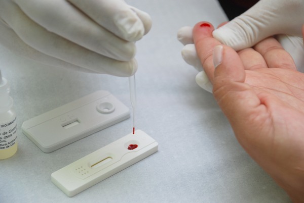 Saúde divulga resultados de pesquisa sobre o HIV em capitais brasileiras Foto: Imagem da Internet