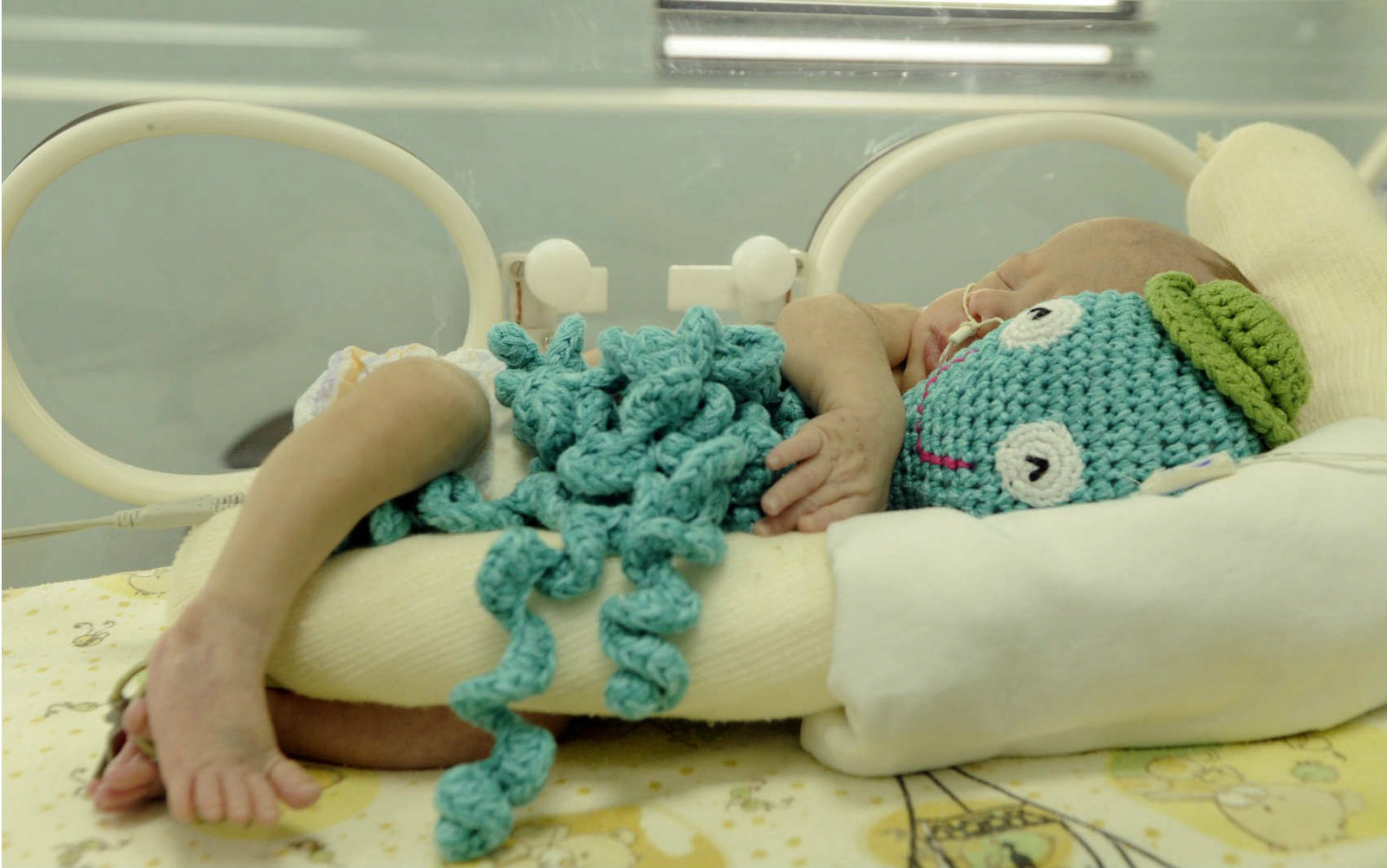 Ministério da Saúde não recomenda uso de polvos de crochê em incubadoras Bebê prematuro com polvo de crochê em UTI do Hospital de Santa Maria, no Df (Foto: Matheus Oliveira/GDF/Divulgação)
