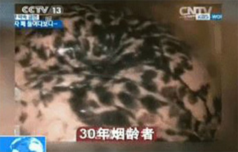 Vídeo de pulmão de fumante causa enorme repercussão após ser divulgado por emissora chinesa