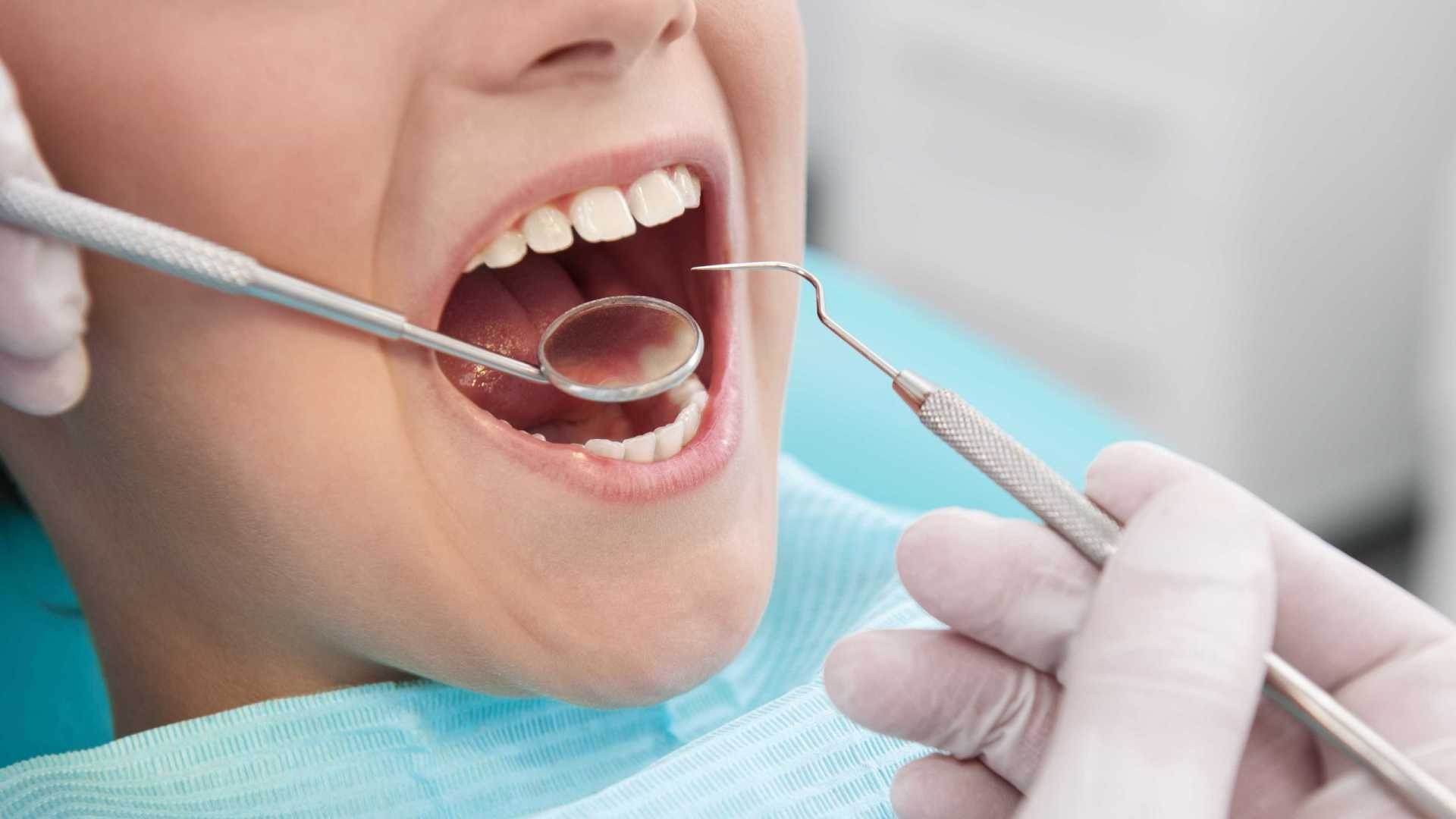 Restaurações dentárias escurecidas devem ser trocadas pelas brancas? Restaurações dentárias escurecidas devem ser trocadas pelas brancas?