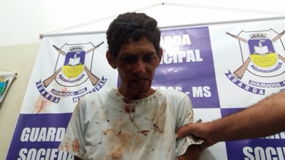 Ladrão é espancado e vai parar no hospital após tentar roubar mulheres no Flórida Crédito Osvaldo Duarte