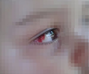 Em imagens registradas pela tia, a criança aparece com o canto do olho vermelho - Arquivo pessoal