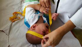 Brasil enfrenta uma epidemia de Zika, acompanhada de um aumento do número de casos de microcefalia (Foto:Sumaia Villela/Agência Brasil)